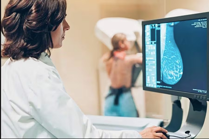 Paraguay reduce casi 20 % las muertes por cáncer de mama en cinco años Paraguay reduce casi 20 % las muertes por cáncer de mama en cinco años