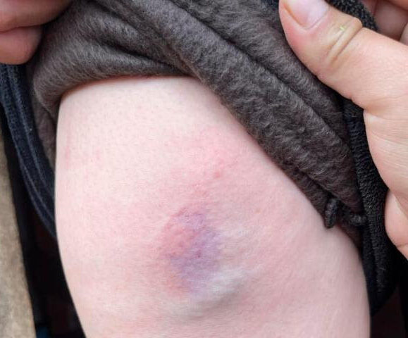 Ameaças, perseguição e mortes: indígenas denunciam aumento da violência política Ameaças, perseguição e mortes: indígenas denunciam aumento da violência política